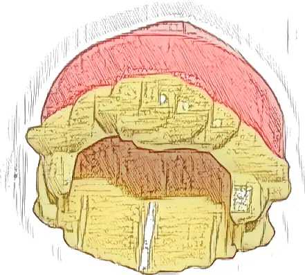 Mini Doll, Hair Combo, Hair with Hat, Short Tousled with Molded Coral Beanie / Knit Cap Pattern